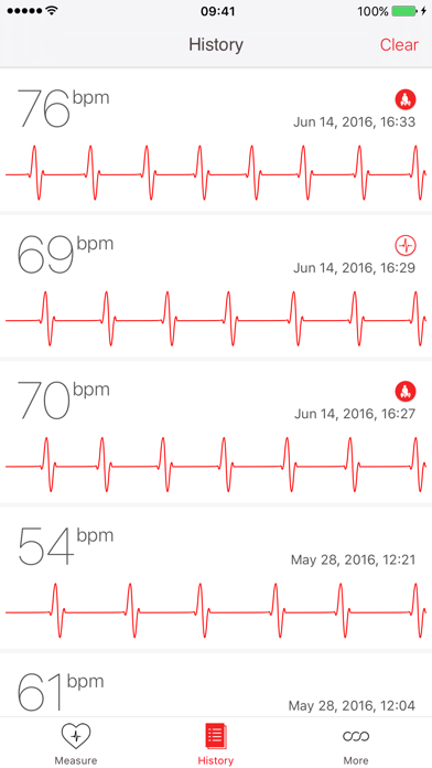 Cardiograph 1.2 Download